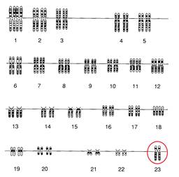 Image shows a Karyotype that only has one chromosome on the 23rd pair