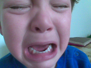 A photograph of a young child's face. The child is crying.